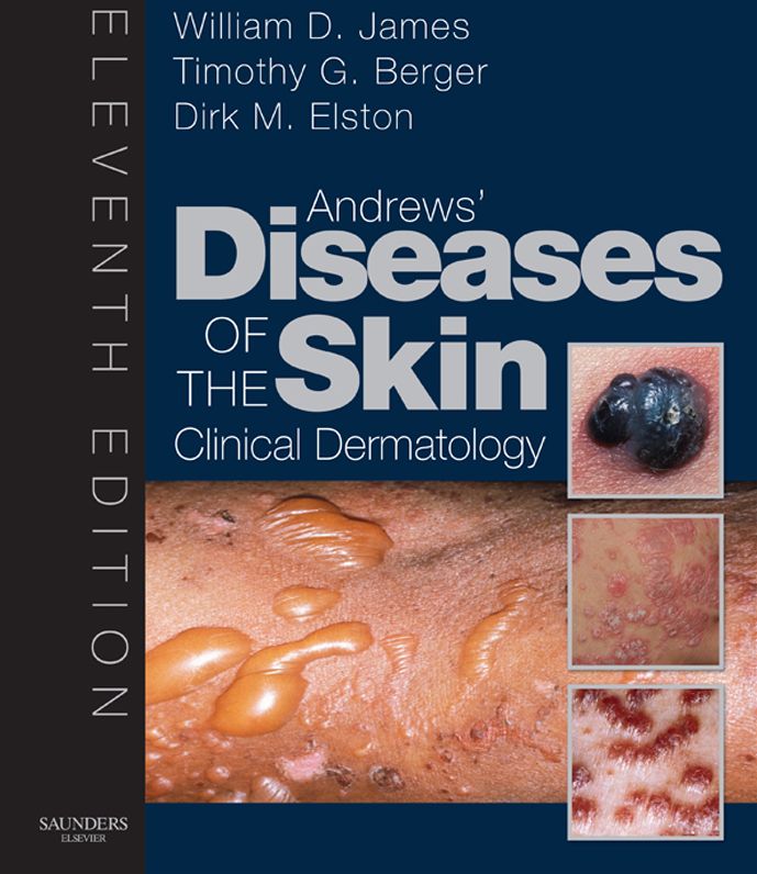 Andrew's Diseases of the Skin E-Book: Clinical Dermatology