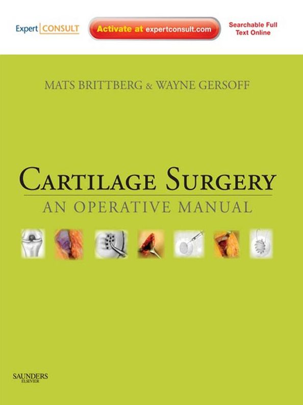 Cartilage Surgery E-Book: An Operative Manual, with Expert Consult