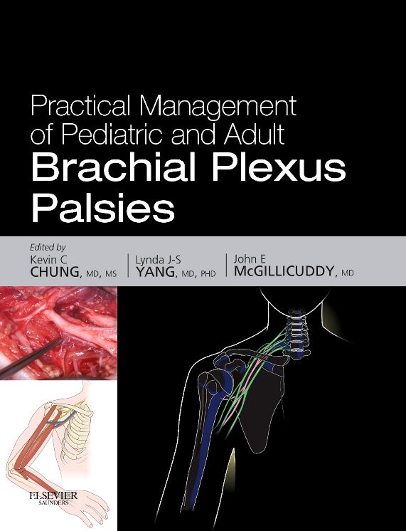 Practical Management of Pediatric and Adult Brachial Plexus Palsies E-Book