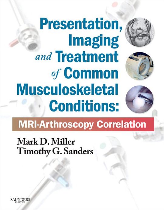 Presentation, Imaging and Treatment of Common Musculoskeletal Conditions E-Book: MRI-Arthroscopy Correlation