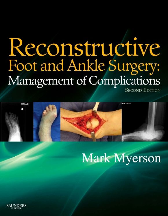 Reconstructive Foot and Ankle Surgery: Management of Complications E-Book: Expert Consult