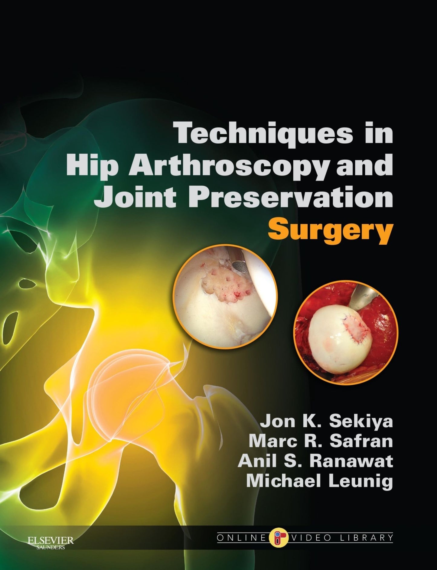 Techniques in Hip Arthroscopy and Joint Preservation E-Book: Expert Consult: Online and Print with DVD