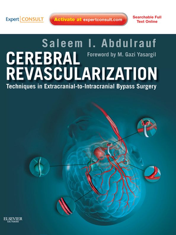 Cerebral Revascularization - E-Book: Techniques in Extracranial-to-Intracranial Bypass Surgery: Expert Consult