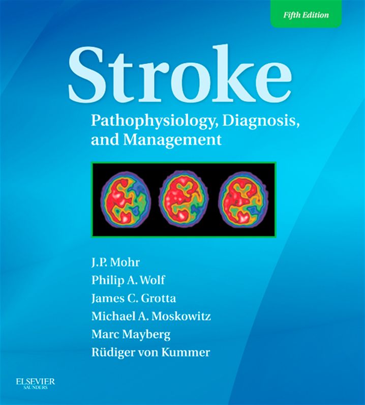 Stroke E-Book: Pathophysiology, Diagnosis, and Management