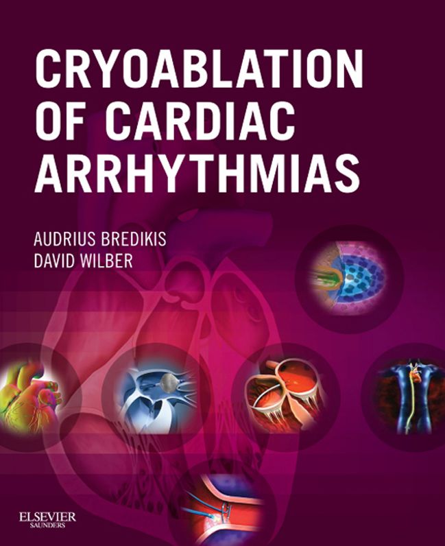 Cryoablation of Cardiac Arrhythmias E-Book