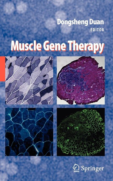 Muscle Gene Therapy