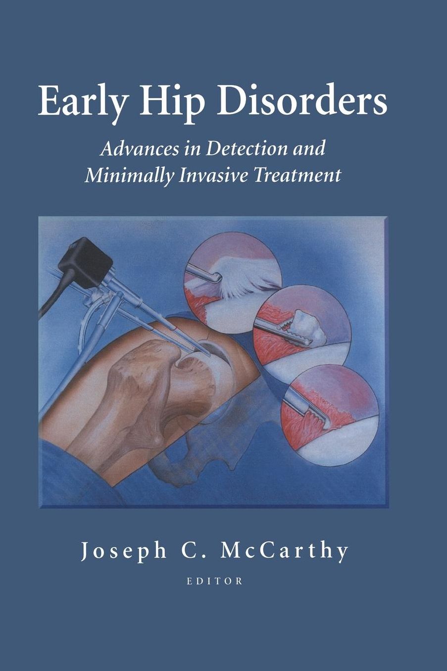 Early Hip Disorders: Advances in Detection and Minimally Invasive Treatment