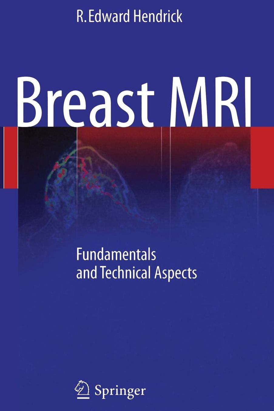Breast MRI: Fundamentals and Technical Aspects