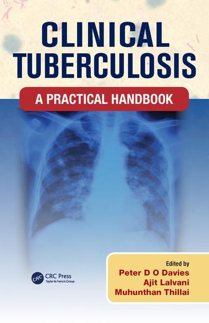 Clinical Tuberculosis: A Practical Handbook