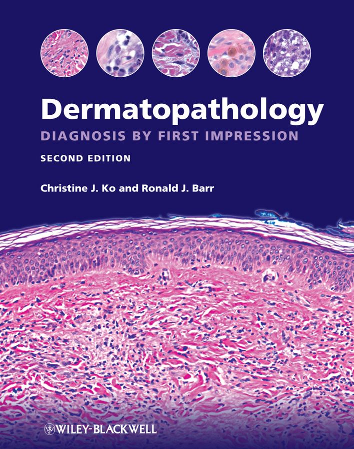 Dermatopathology: Diagnosis by First Impression