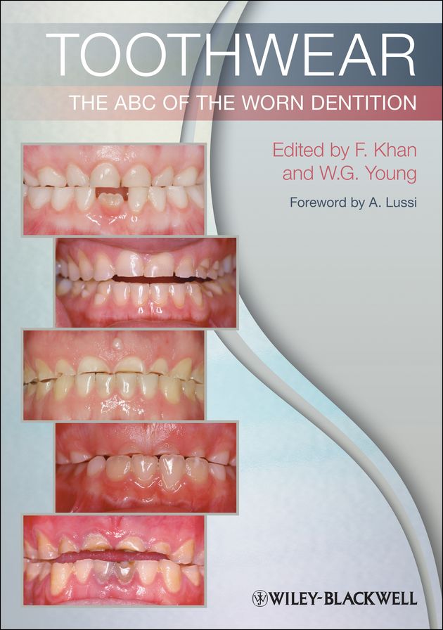 Toothwear: The ABC of the Worn Dentition