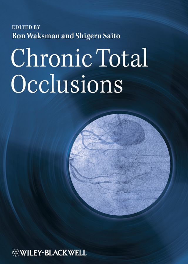 Chronic Total Occlusions: A Guide to Recanalization