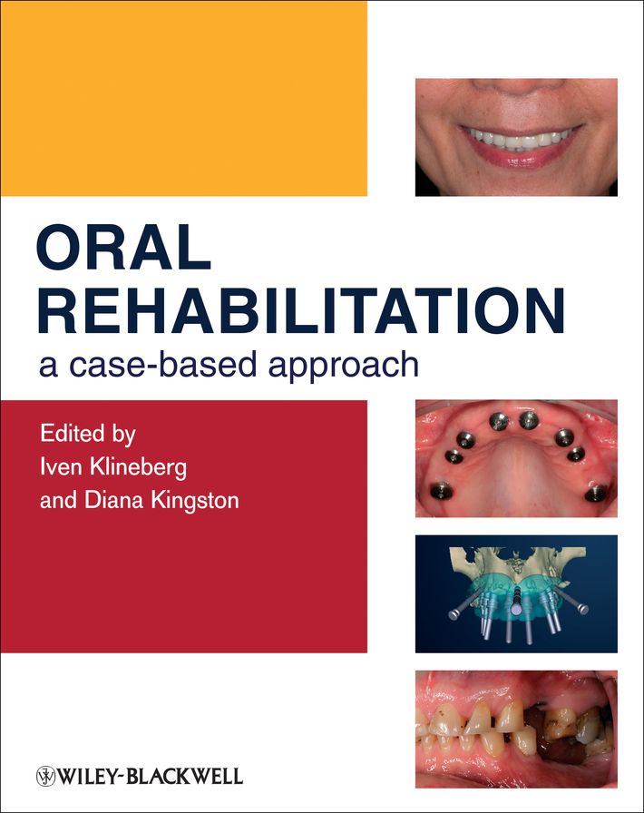 Oral Rehabilitation: A Case-Based Approach