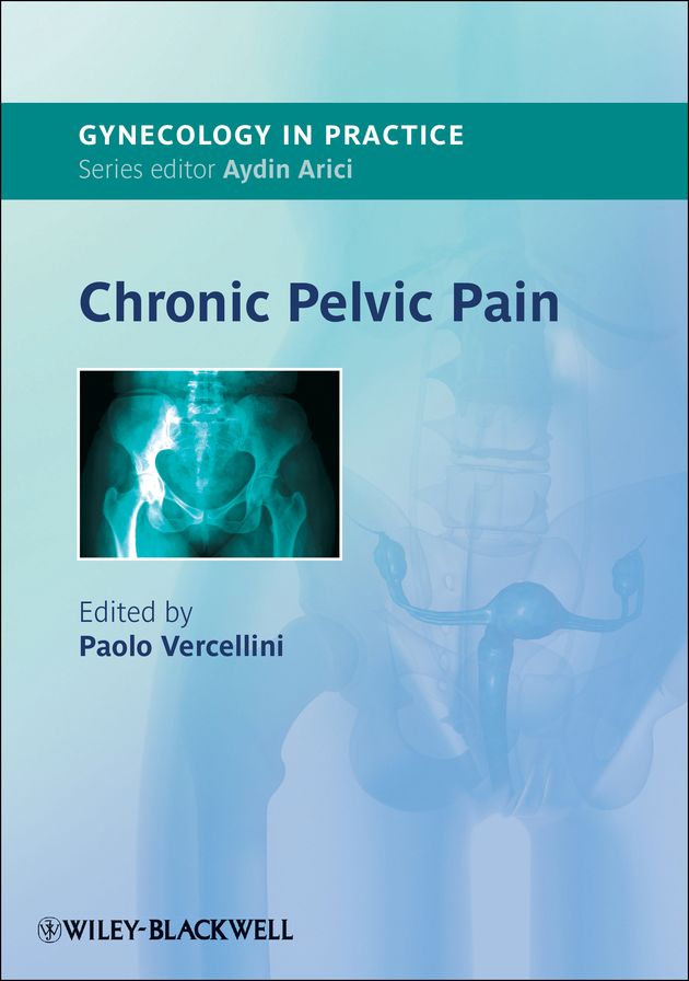 Chronic Pelvic Pain