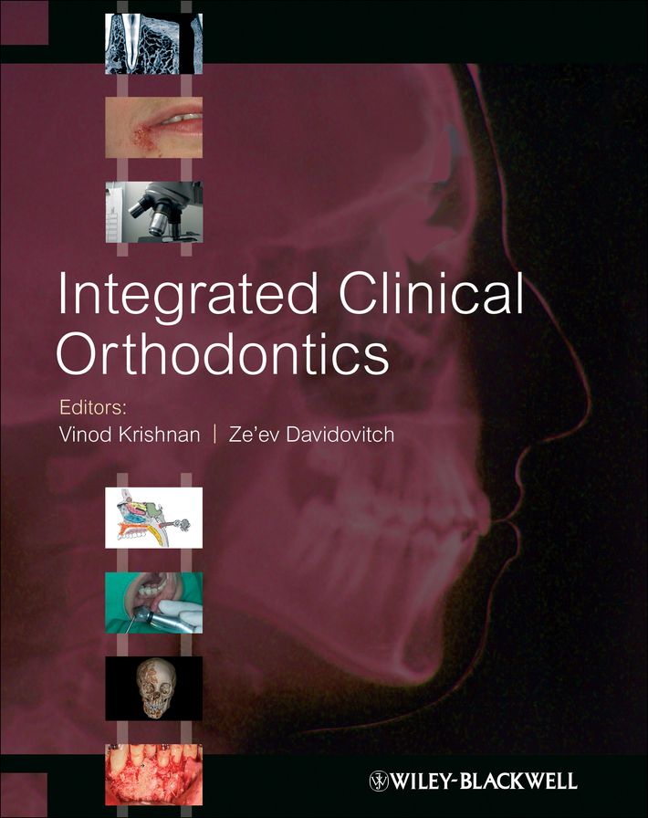 Integrated Clinical Orthodontics