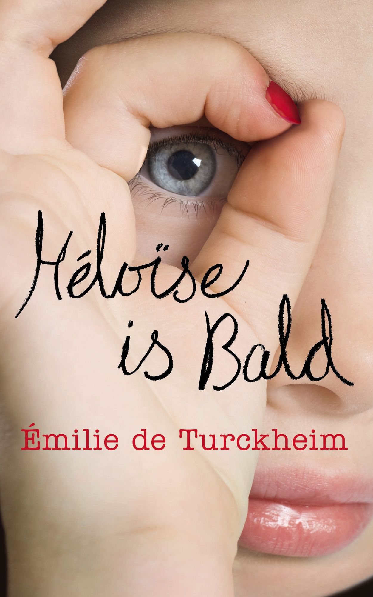 Héloïse is Bald