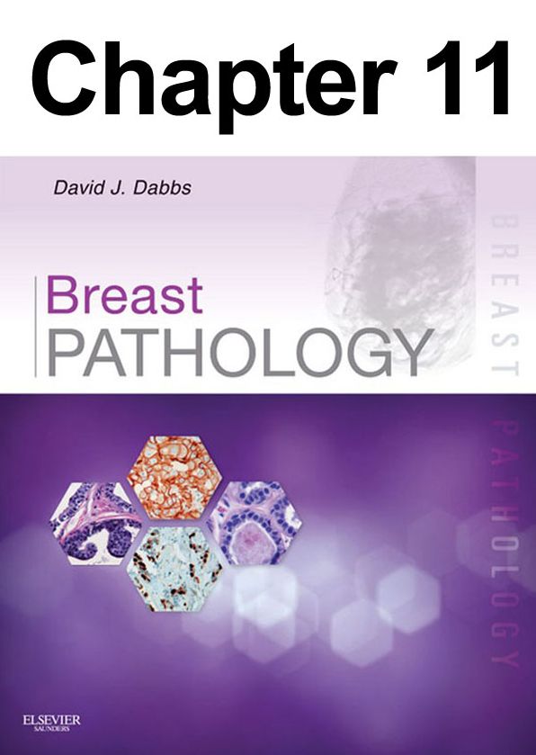 Diagnostic Immunohistology of the Breast: Chapter 11 of Breast Pathology