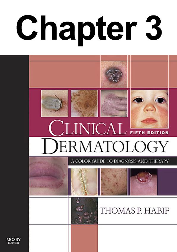 Eczema and Hand Dermatitis: Chapter 3 of Clinical Dermatology