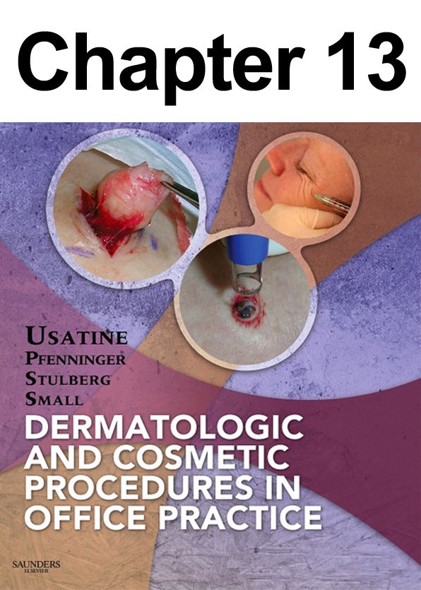 Flaps: Chapter 13 of Dermatologic and Cosmetic Procedures in Office Practice
