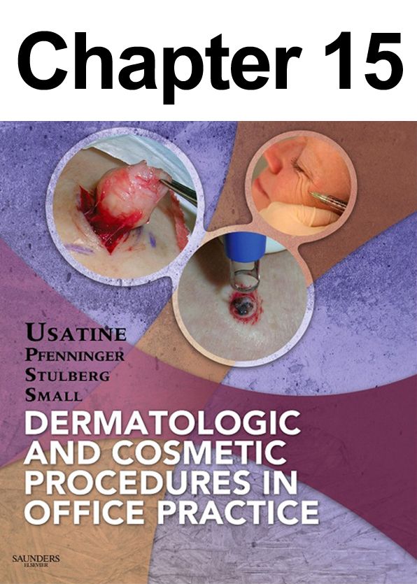 Cryosurgery: Chapter 15 of Dermatologic and Cosmetic Procedures in Office Practice