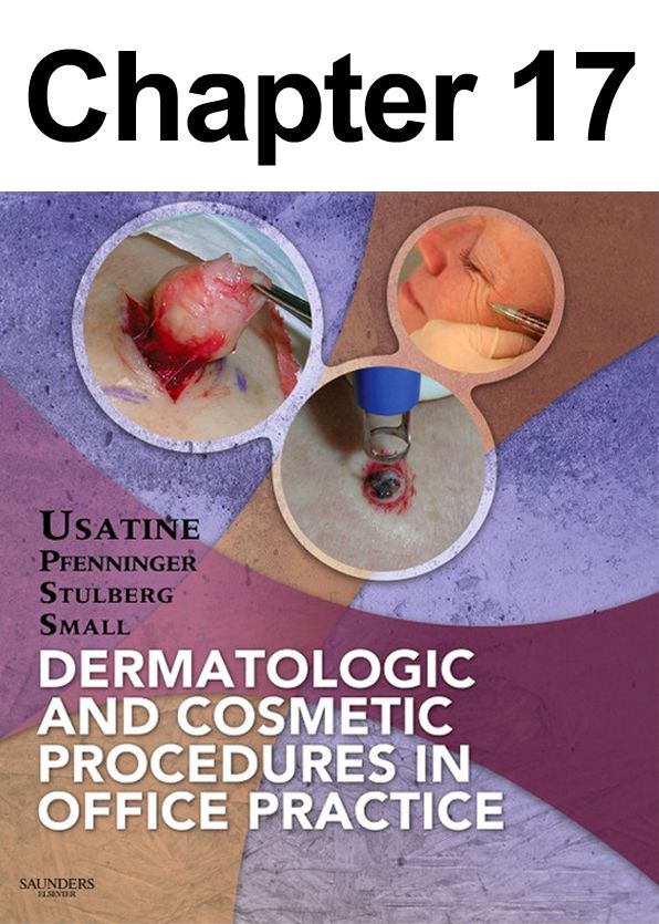 Incision and Drainage: Chapter 17 of Dermatologic and Cosmetic Procedures in Office Practice