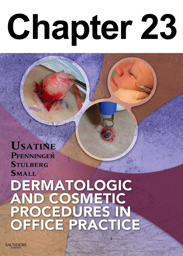 Microdermabrasion: Chapter 23 of Dermatologic and Cosmetic Procedures in Office Practice