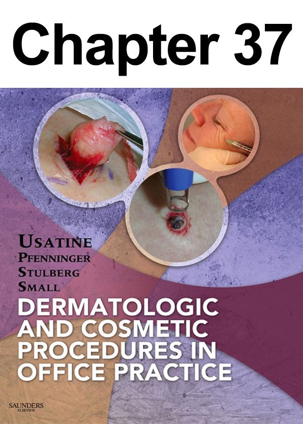 When to Refer/Mohs Surgery: Chapter 37 of Dermatologic and Cosmetic Procedures in Office Practice