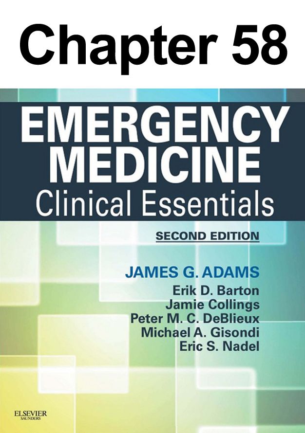 Bradyarrhythmias: Chapter 58 of Emergency Medicine