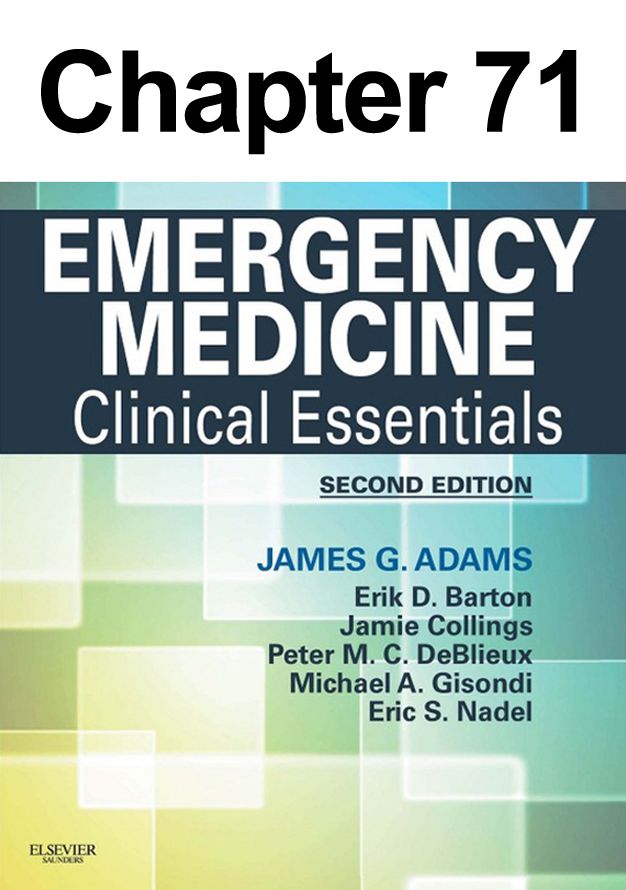 Venous Thrombosis: Chapter 71 of Emergency Medicine