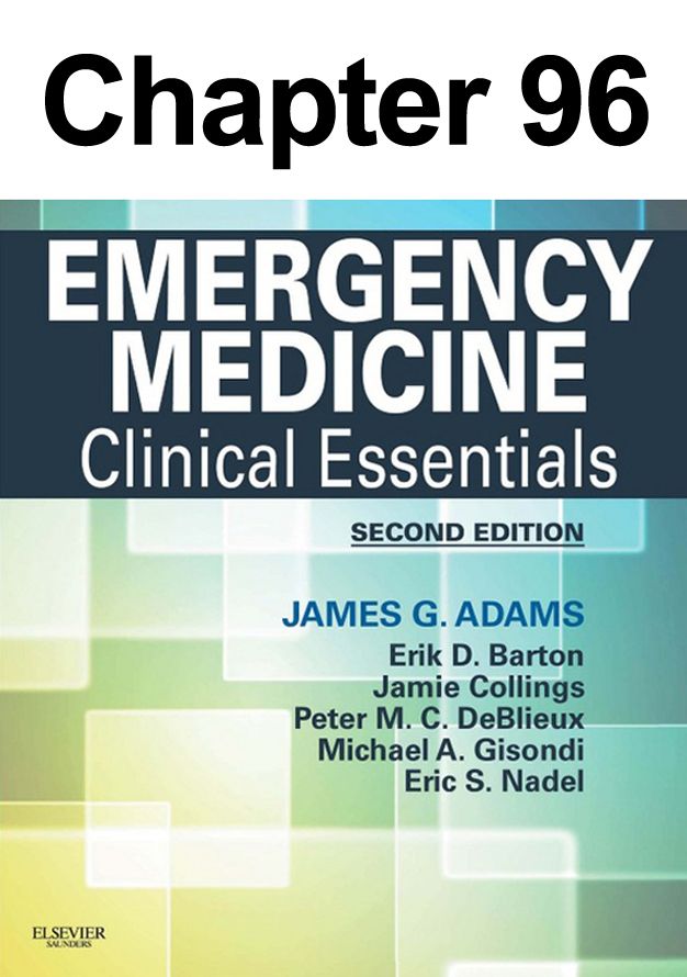 Vertigo: Chapter 96 of Emergency Medicine