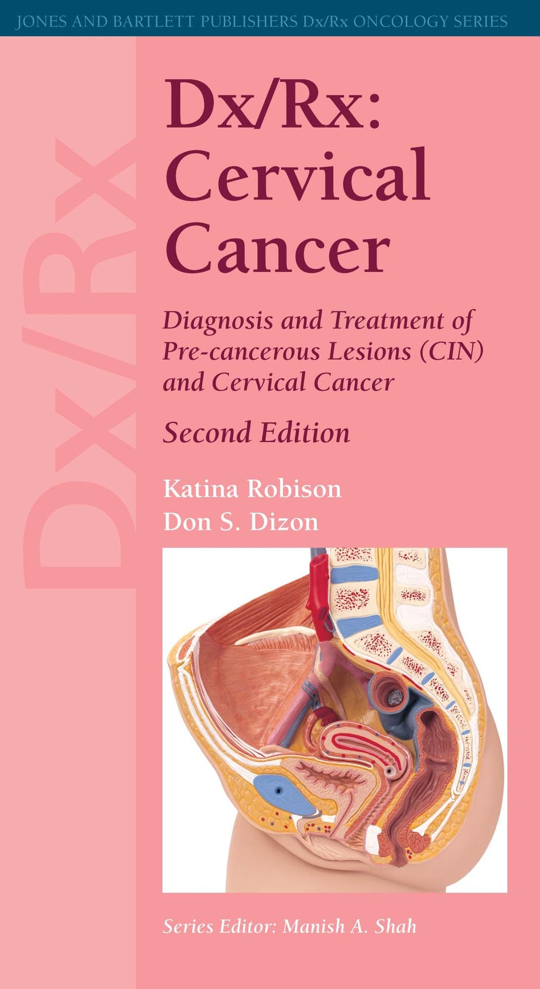 Dx/Rx: Cervical Cancer: Cervical Cancer