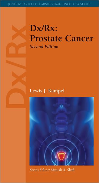Dx/Rx: Prostate Cancer: Prostate Cancer