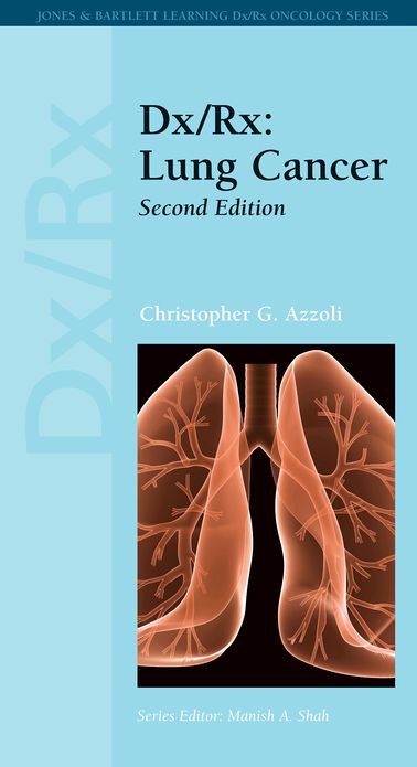 Dx/Rx: Lung Cancer: Lung Cancer