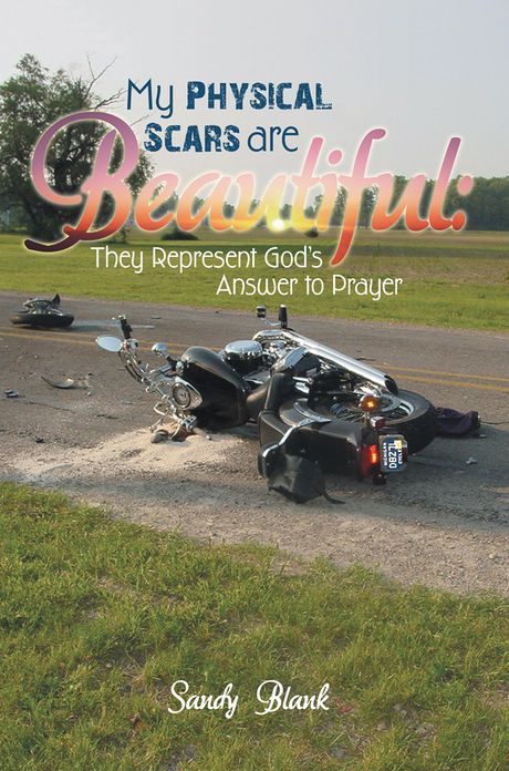 My Physical Scars are Beautiful:: They Represent God's Answer to Prayer