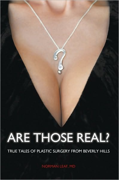 Are Those Real?: True Tales of Plastic Surgery from Beverly Hills