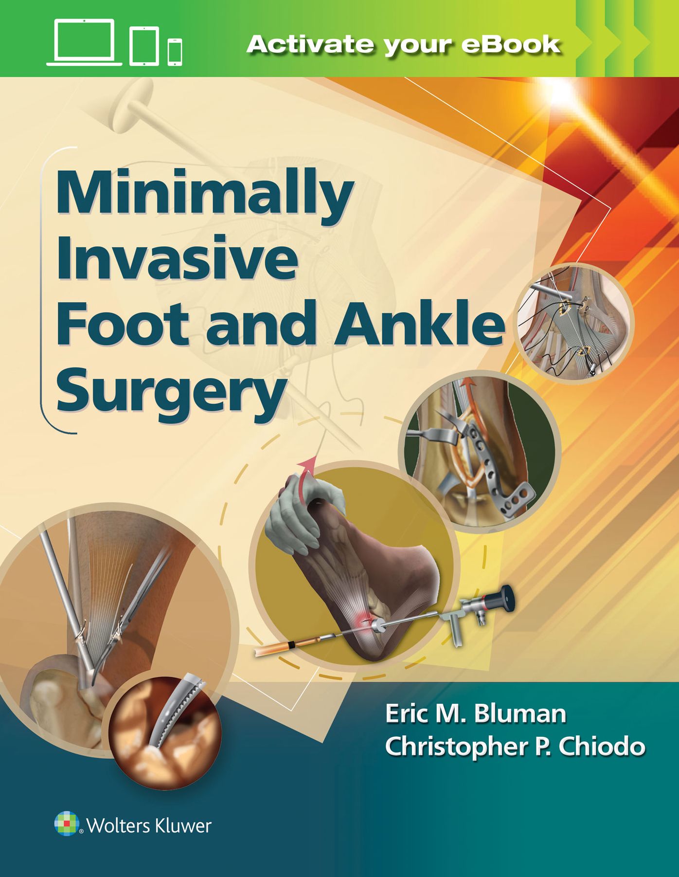 Minimally Invasive Foot & Ankle Surgery