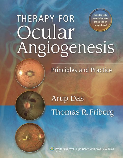 Therapy for Ocular Angiogenesis: Principles and Practice