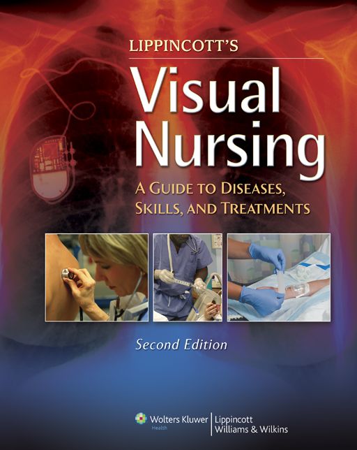 Lippincott's Visual Nursing: A Guide to Diseases, Skills, and Treatments