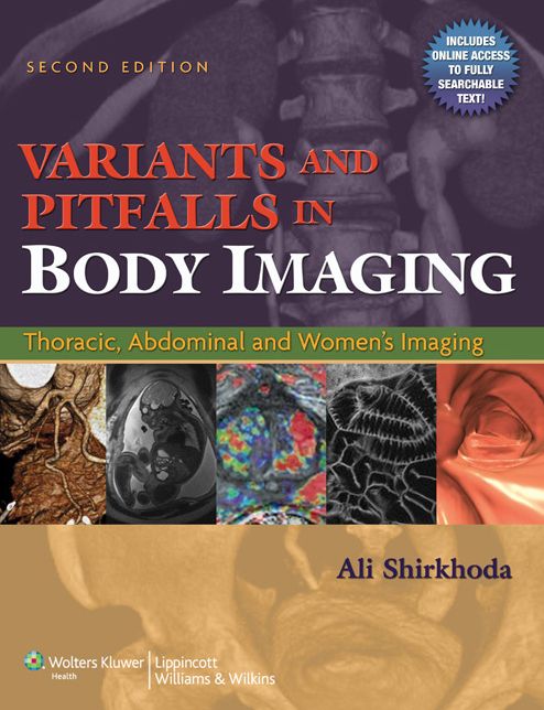 Variants and Pitfalls in Body Imaging: Thoracic, Abdominal and Women's Imaging