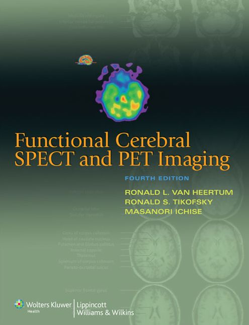 Functional Cerebral SPECT and PET Imaging