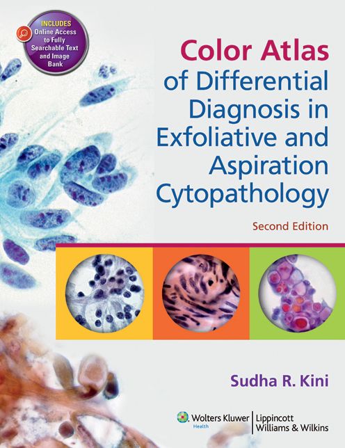 Color Atlas of Differential Diagnosis in Exfoliative and Aspiration Cytopathology