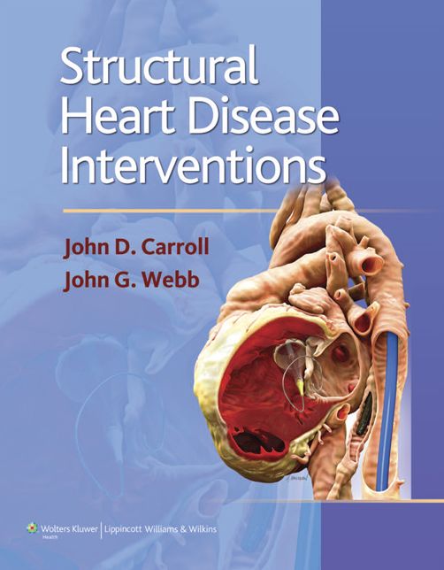 Structural Heart Disease Interventions