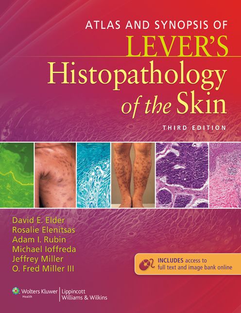 Atlas and Synopsis of Lever's Histopathology of the Skin