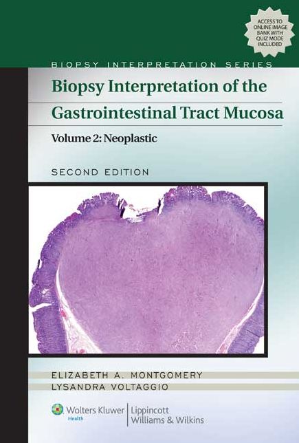 Biopsy Interpretation of the Gastrointestinal Tract Mucosa: Volume 2: Neoplastic