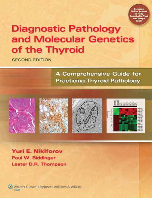Diagnostic Pathology and Molecular Genetics of the Thyroid: A Comprehensive Guide for Practicing Thyroid Pathology