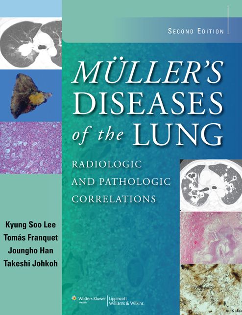 Muller's Diseases of the Lung: Radiologic and Pathologic Correlations