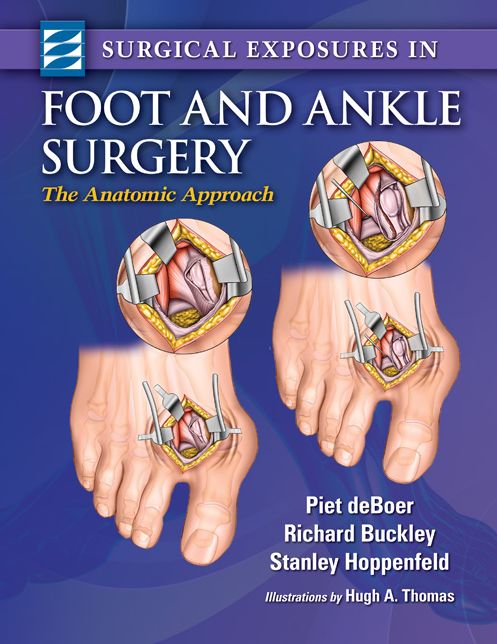 Surgical Exposures in Foot & Ankle Surgery: The Anatomic Approach