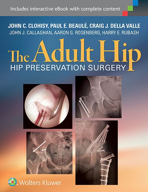 The Adult Hip: Hip Preservation Surgery