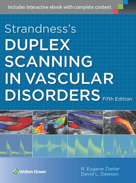 Strandness's Duplex Scanning in Vascular Disorders