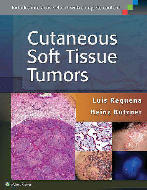 Cutaneous Soft Tissue Tumors